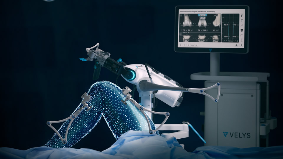 VELYS-Robotersystem im Einsatz bei der Knie-TEP-Implantation